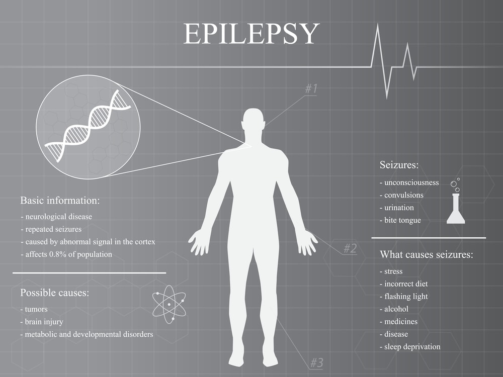 Epilepsy Disease Infographic Man